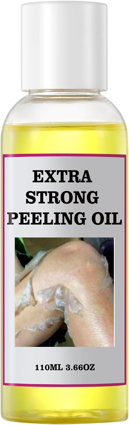 Yellow Peeling Oil for Dark Skin Strong Peel Oil Extra Strength Exfoliating Chemical Exfoliant Peels Solution at Home Body Peeling for Exfoliate Body Hand Foot Knuckle All Skin Type 3.66 OZ